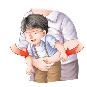 海姆立克法 海姆立克法