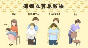 海姆立克急救法 海姆立克急救法