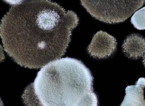 霉菌感染 霉菌感染